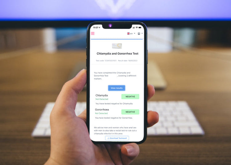 Chlamydia zelf afnametest man