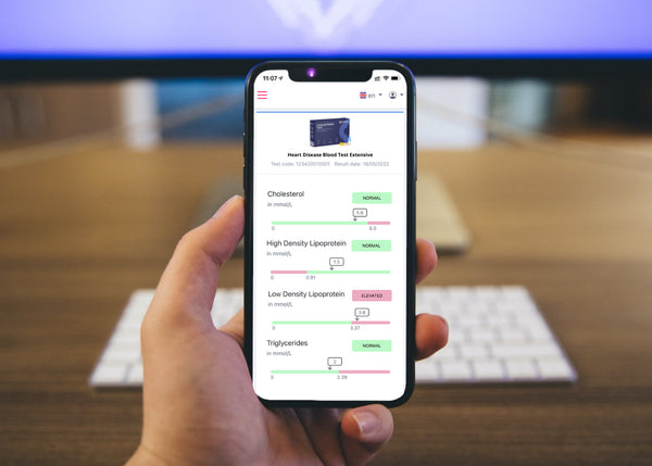 Hart- en vaatziekten test uitgebreid
