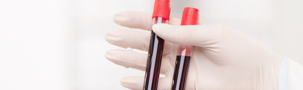 Haemoglobin: what a low haemoglobin level can mean for your health