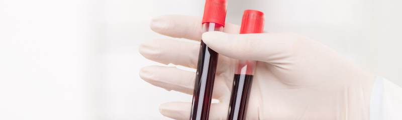 Hemoglobine: wat een lage hemoglobinewaarde voor je gezondheid kan betekenen
