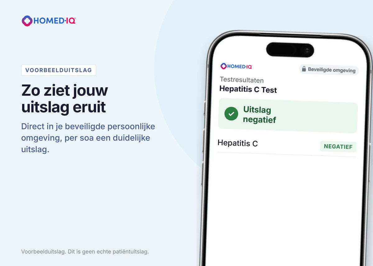 6a987ffc33f9f_Hepatitis-C-portal-example-NL.webp